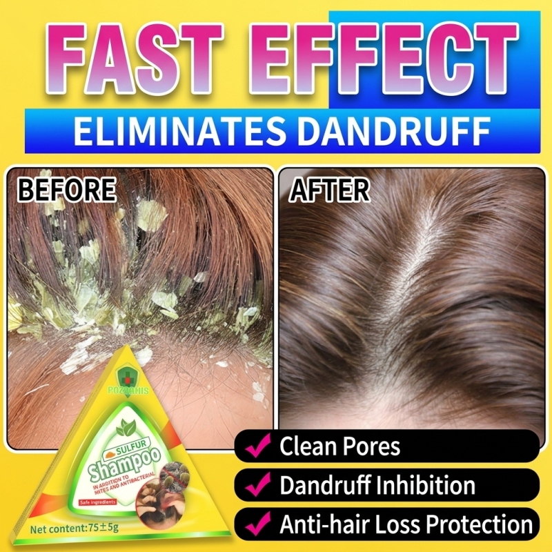 Hair Care Dandruff - แชมพูบาร์สูตรพฤกษศาสตร์สำหรับผู้ชายและผู้หญิง ช่วยฟื้นฟูผมบางอย่างรุนแรง บำรุงรากผมลึก ทำความสะอาดหนังศีรษะ ขจัดสารพิษ ลดปัญหาผมร่วง
