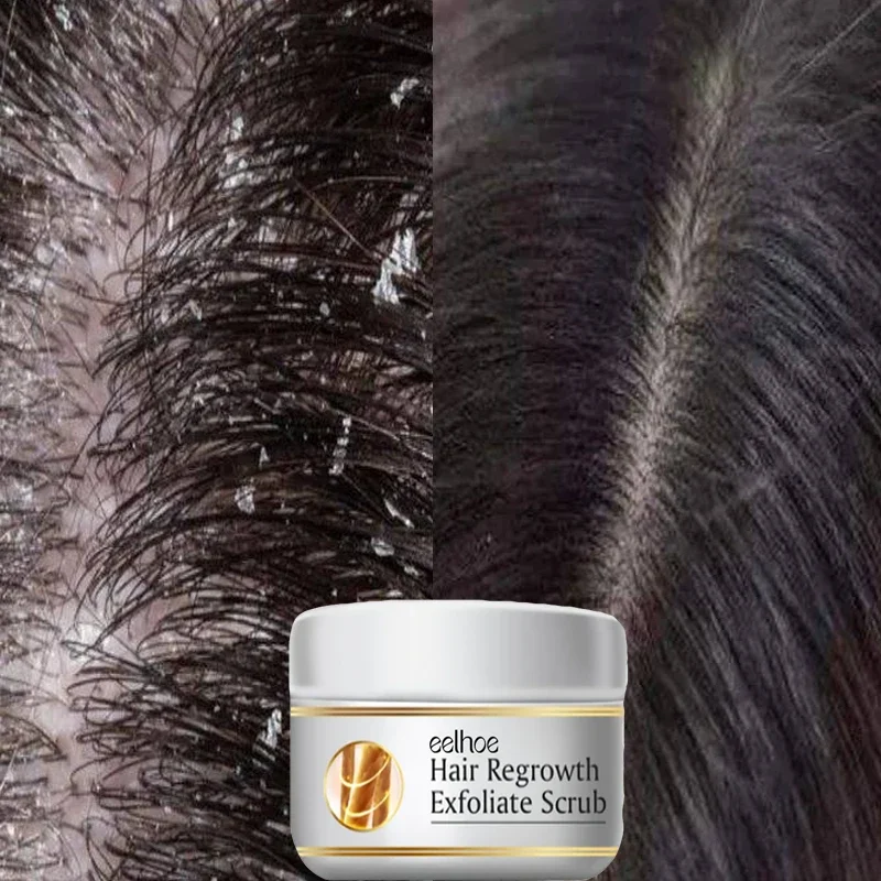 สครับขจัดรังแคสูตรเร่งด่วน บรร - Hair Care Dandruff บทวิจารณ์และราคา