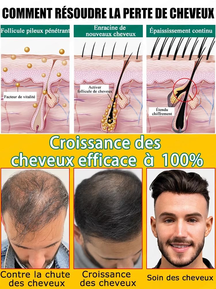ส่วนผสมจากพืชที่อ่อนโยนช่วยดูแ - Hair Care Natural Ingredients บทวิจารณ์และราคา