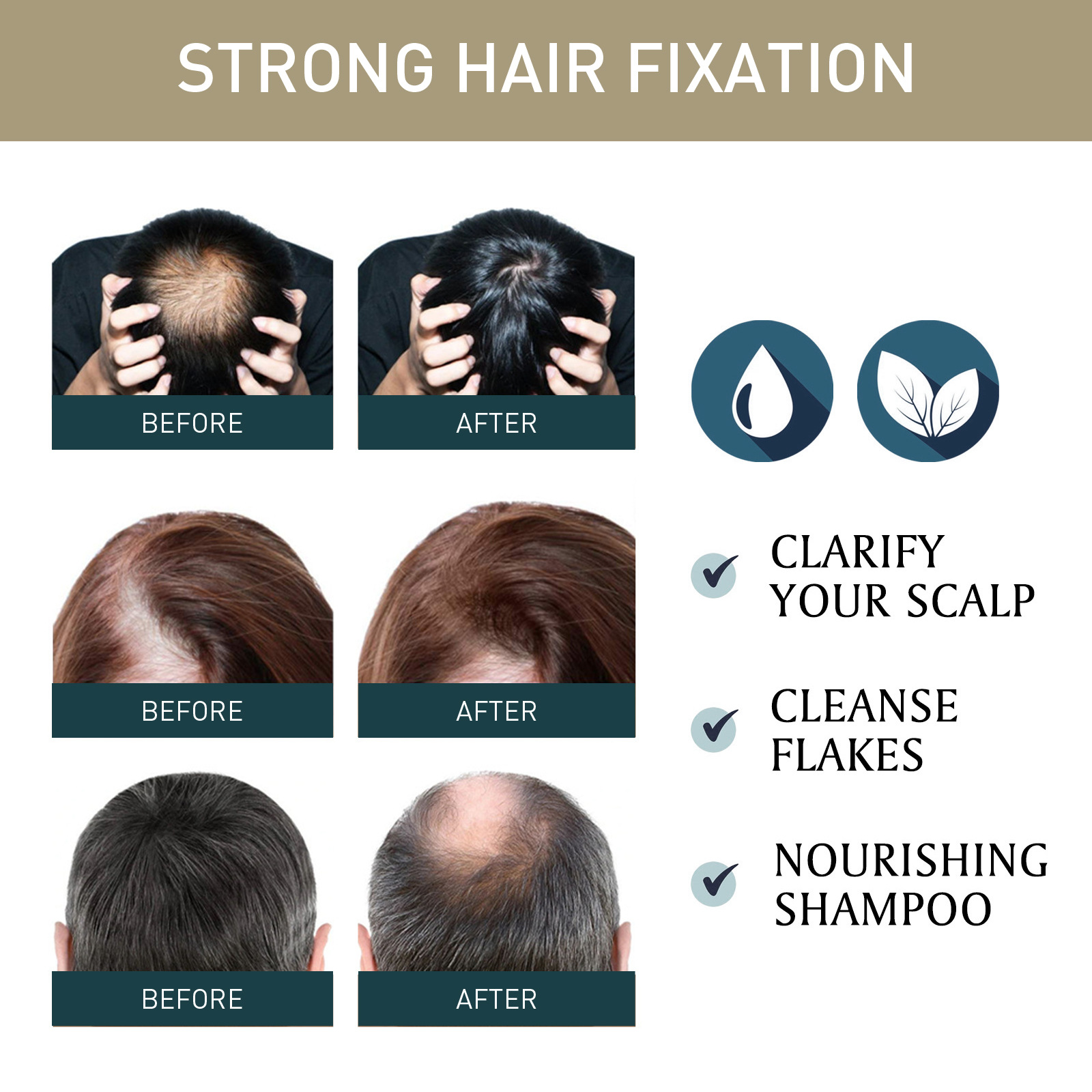 2 ชิ้น x 100 มล. แชมพูปลูกผม ส - Hair Care Natural Ingredients บทวิจารณ์และราคา