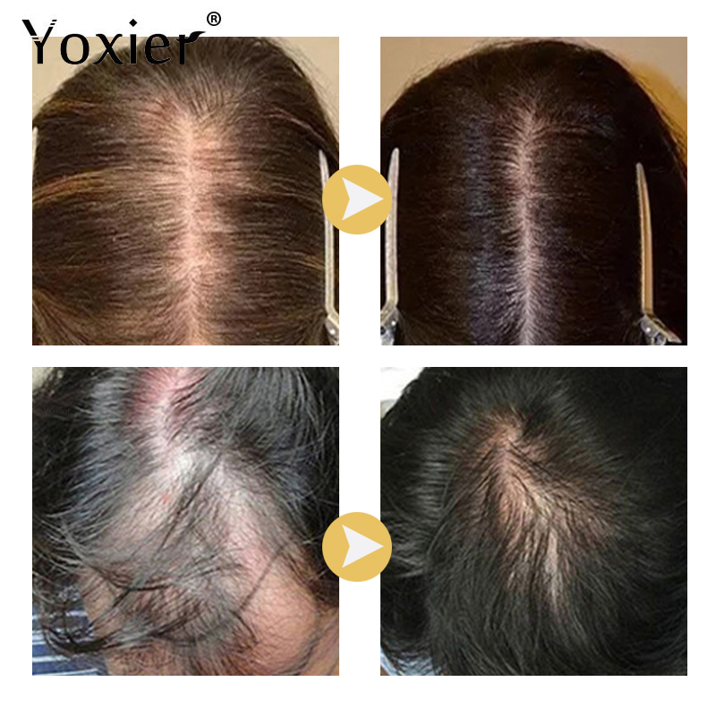 Intensive Growth Serum ป้องกัน - Hair Care For Hair Growth บทวิจารณ์และราคา