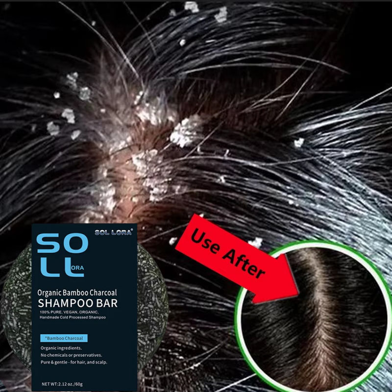 Fast Anti Dandruff Hair Treatm - Hair Care Dandruff บทวิจารณ์และราคา