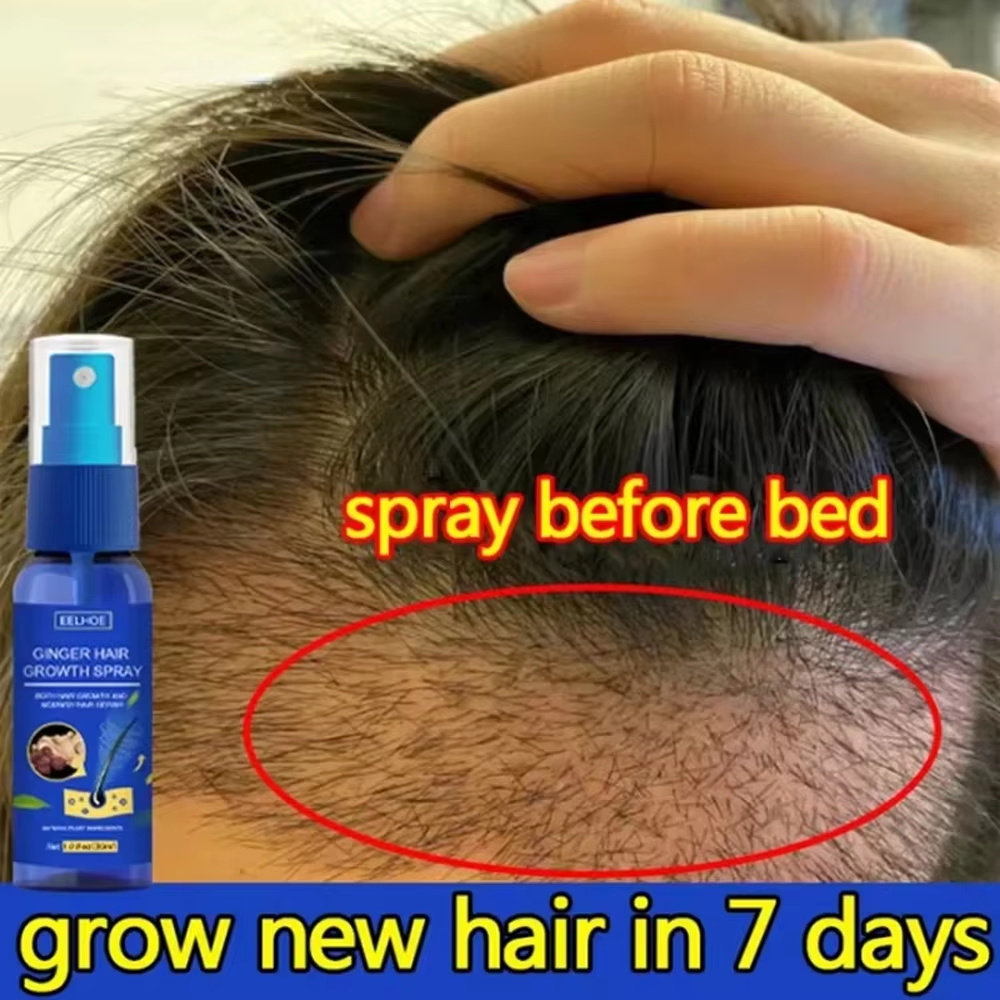 สเปรย์เร่งผมยาวขึ้นอย่างรวดเร็ - Hair Care For Hair Growth บทวิจารณ์และราคา