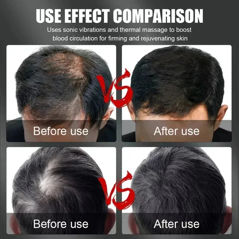 หมวกบำบัดผมด้วยแสงสีแดงอินฟราเ - Hair Care For Hair Growth บทวิจารณ์และราคา